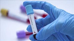 افزایش شمار مبتلایان به ویروس کرونا در  استان به ۵۳۶ نفر